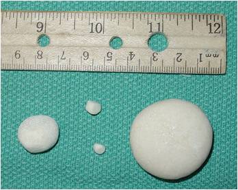 Kidney Stones in Dogs