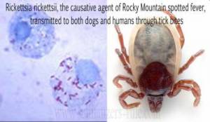 Rocky Mountain Spotted Fever (RMSF) is a disease caused by a microscopic parasite known as Rickettsia rickettsii